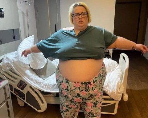 Danielle before her bariatric surgery