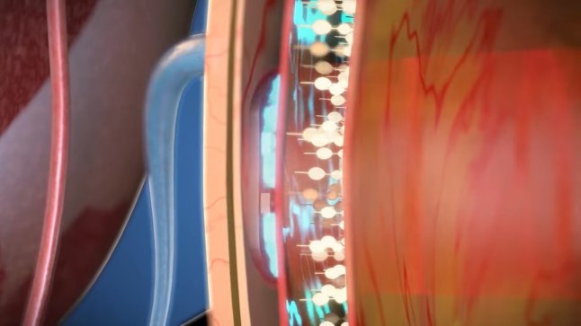 Elon Musk?s competitor creates revolutionary eye chip that restores vision in world's first