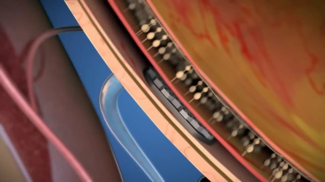 Elon Musk?s competitor creates revolutionary eye chip that restores vision in world's first