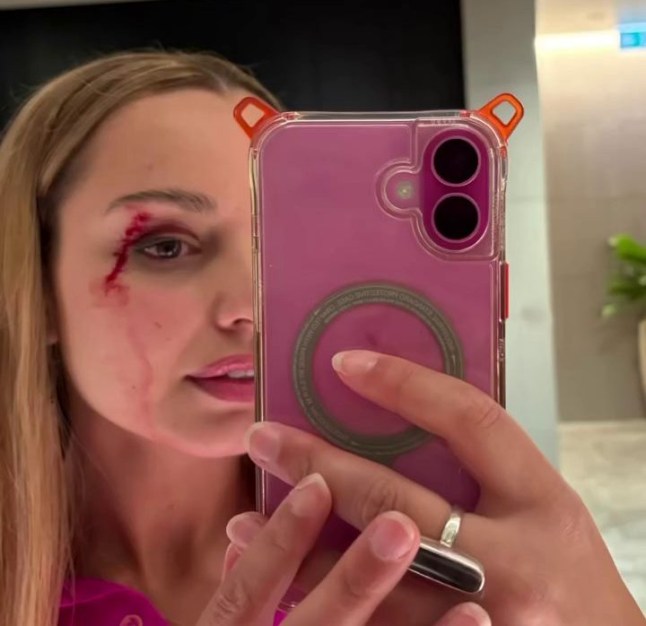 15347161 - New Zealand reporter hit by a bird on camera