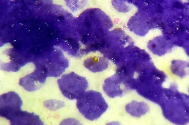 A micro sculpture of a yellow smiley face on purple blotches