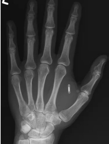 Magician, Zi Teng Wang, ?forgot the password to his own hand?